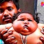 女宝宝出生后22.5公斤，6年后成为最胖女童